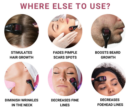 Rosemary Oil 15 ml & Derma Roller For Hairfall Control & Hair Growth.